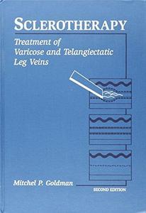 Sclerotherapy : Treatment of Varicose and Telangiectatic Leg Veins