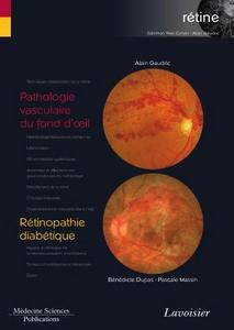 Pathologie vasculaire du fond d'oeil