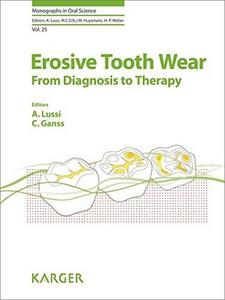 Erosive tooth wear : from diagnosis to therapy