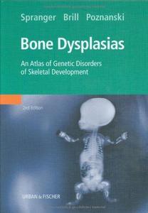 Bone Dysplasias.
