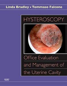 Hysteroscopy : office evaluation and management of the uterine cavity