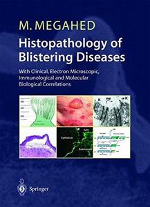 Histopathology of blistering diseases : with clinical, electron microscopic, immunological and molecular biological correlations